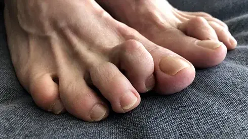 Hammer Foot